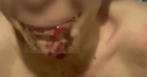 Captura de vídeo que muestra un primer plano del rostro de un menor con lesiones visibles en los labios y restos de sangre seca alrededor de la boca y en el cuello. La imagen está pixelada en la zona de la boca para proteger su identidad y ilustra la denuncia de la agresión sufrida en Gerena.